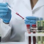 Biochemical research of blood, lab assistant doing microbiological analysis
