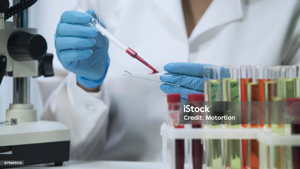 Biochemical research of blood, lab assistant doing microbiological analysis